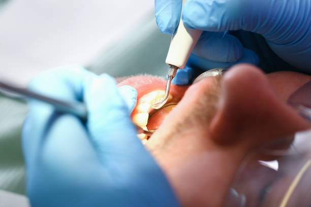 Best Emergency Tooth Extraction in Corinth, TX